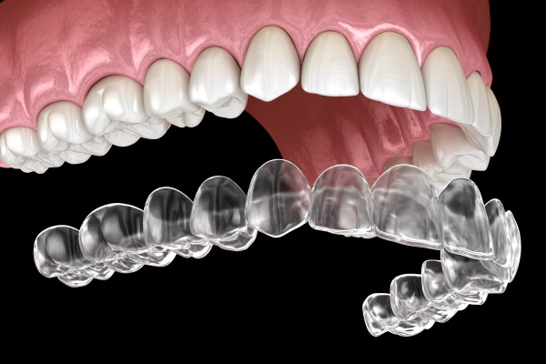 Clear Aligner Treatment in Bakırköy Istanbul