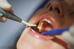 implant çürür mü