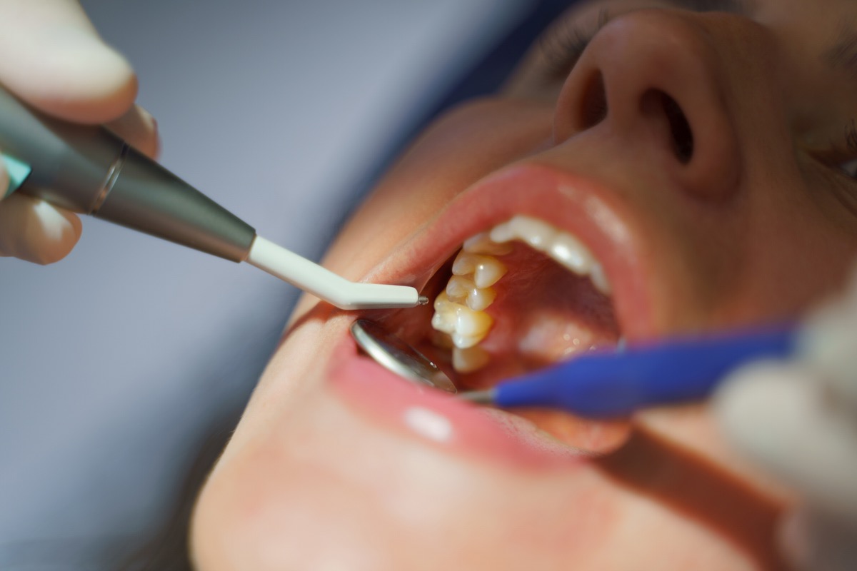 implant çürür mü